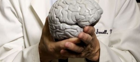Vedci zistili, čo môže pomáhať pri mozgovej príhode 