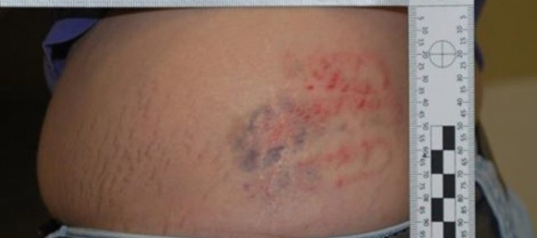 Foto: Pavol dlhé mesiace týral družku, skončil vo väzbe