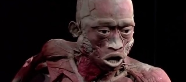 Lekári sa búria proti netradičnej výstave, ponižuje vraj ľudskú dôstojnosť