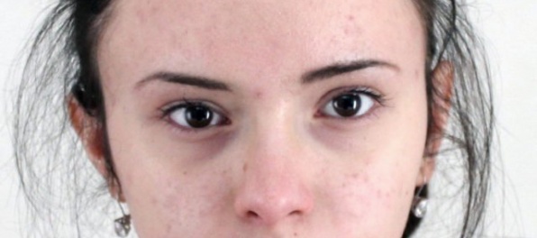 Polícia pátra po tínedžerke, ktorá ušla zo zariadenia Komunita Ľudovítov