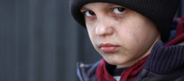 Maloletí Ján a Adriana boli zanedbaní a podvyživení, polícia začala trestné stíhanie pre týranie