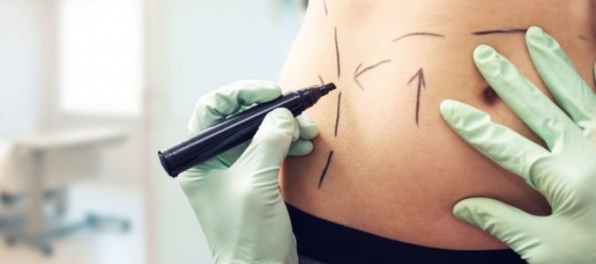 Polícia i nemocnica preverujú podozrenie z nekalých praktík na košickej plastickej chirurgii