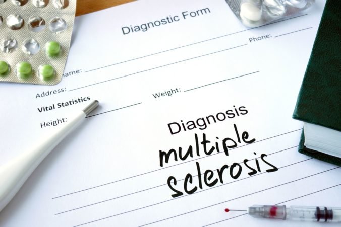 Skleróza multiplex postihuje až takmer trikrát viac žien ako mužov