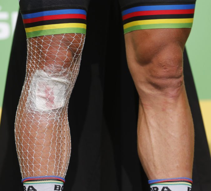 Bol to náročný deň, trpel som pre zranenia a boleli ma nohy, hovorí Sagan po 18. etape Tour de France