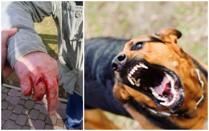 Foto: Na muža s kočíkom zaútočili psy, dohrýzli ho na rukách aj chrbte