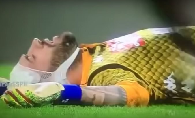 Video: Brankár SSC Neapol Ospina skolaboval počas zápasu a zostal nehybne ležať na trávniku