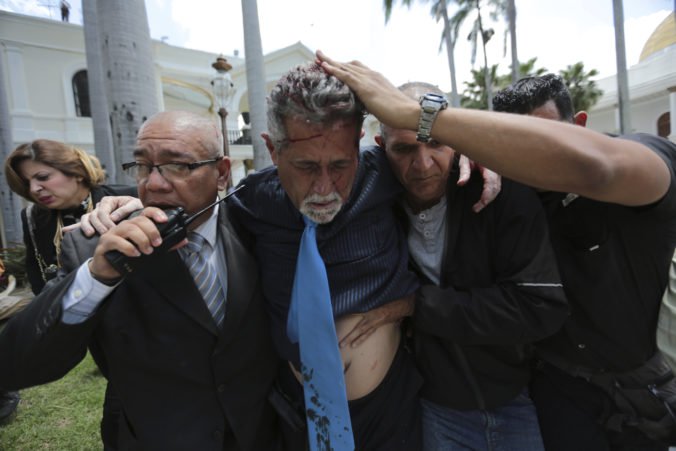Členovi venzuelskej opozície hrozí zatknutie, útočisko mu poskytol taliansky veľvyslanec