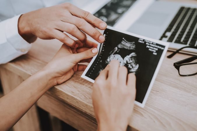 Ženy rozhodnuté pre potrat by mali vidieť obraz embrya a počuť tlkot srdca, navrhuje Dankova SNS