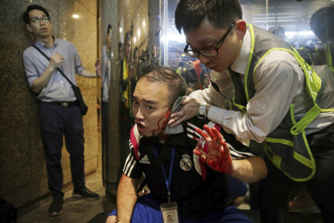 Video: Pred obchodným centrom v Hongkongu útočil muž s nožom, politikovi odhryzol časť ucha
