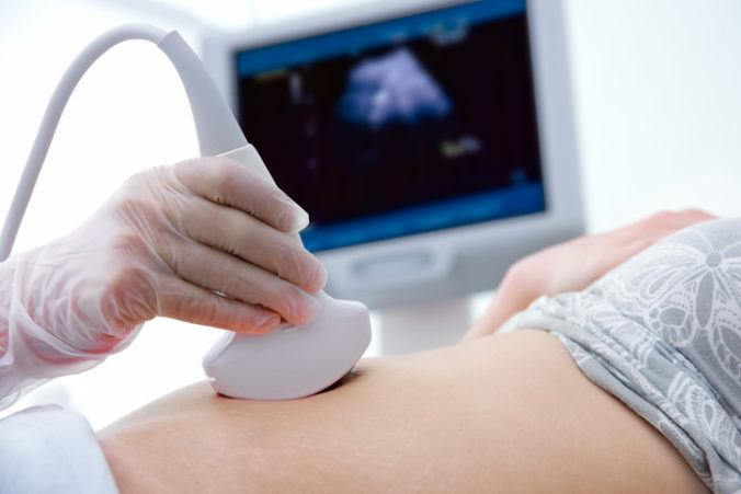 Aliancia za rodinu chce vedieť, či ministerstvo plánuje zakázať Dopplerovo vyšetrenie ultrazvukom