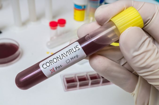 Ste v karanténe pre koronavírus? Sociálna poisťovňa akceptuje PN aj viac ako tri dni spätne