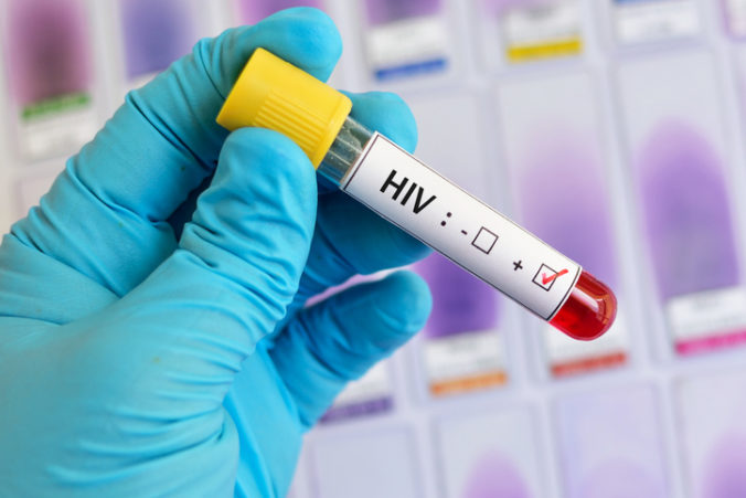 Desiatky HIV pozitívnych žien v Juhoafrickej republike museli podstúpiť nútenú sterilizáciu