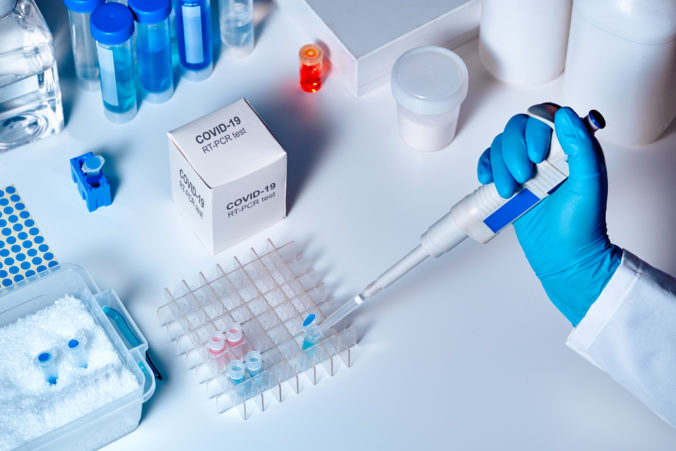 Testov na COVID-19 bude dostatok. Slovenskí biotechnológovia vedia dodať vláde až milión testov a začínajú pracovať aj na vývoji lieku!