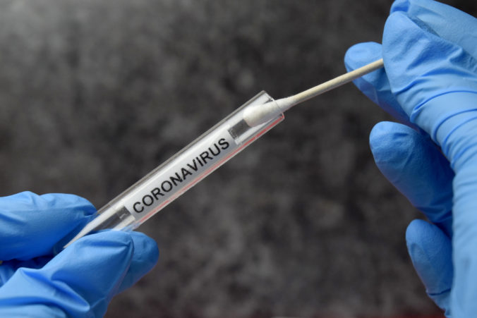 Výskum: Slováci chcú laboratórne testy na koronavírus. Testovanie na protilátky by malo byť súčasťou preventívnych prehliadok