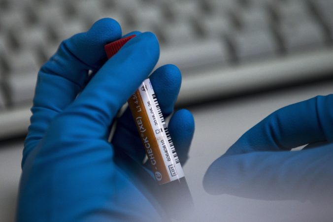 WADA odobrala licenciu moskovskému antidopingovému laboratóriu, pracovníci manipulovali s údajmi