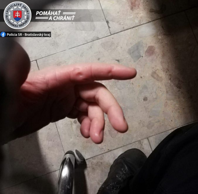 Opitý muž v Bratislave napadol policajtov, jedného pohrýzol aj do prsta