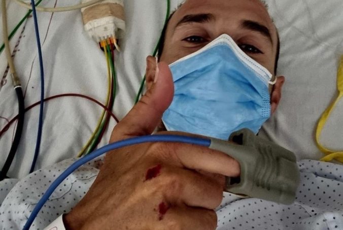 Španielskeho cyklistu Valverdeho zrazilo auto počas tréningu, vodič z miesta nehody ušiel