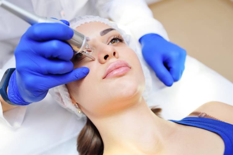 Aké dermatologické metódy odstránenia pigmentácii sa využívajú?
