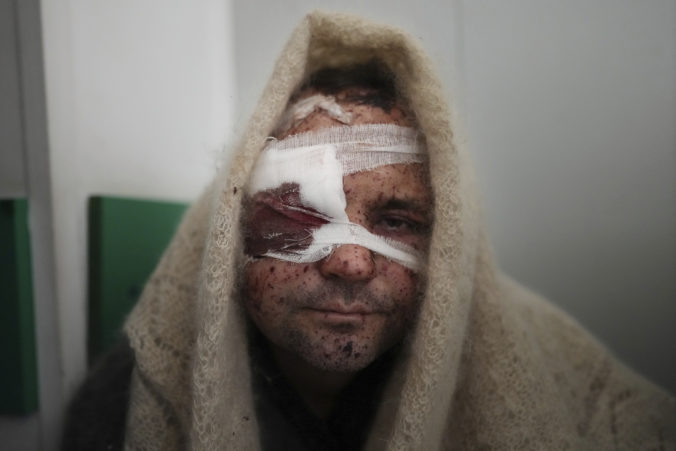 OSN dokumentuje rozsiahle mučenie civilistov zo strany Ruska, desiatky bez súdu popravili