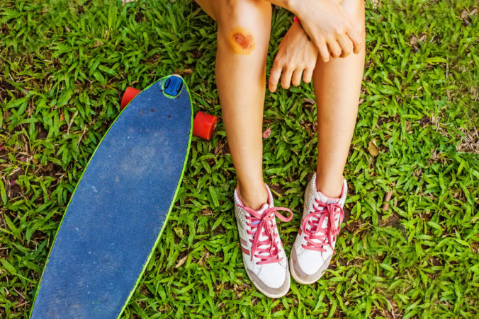 Bol to skateboard či paddleboard? Na tom už nezáleží. Na vašom poistení však áno