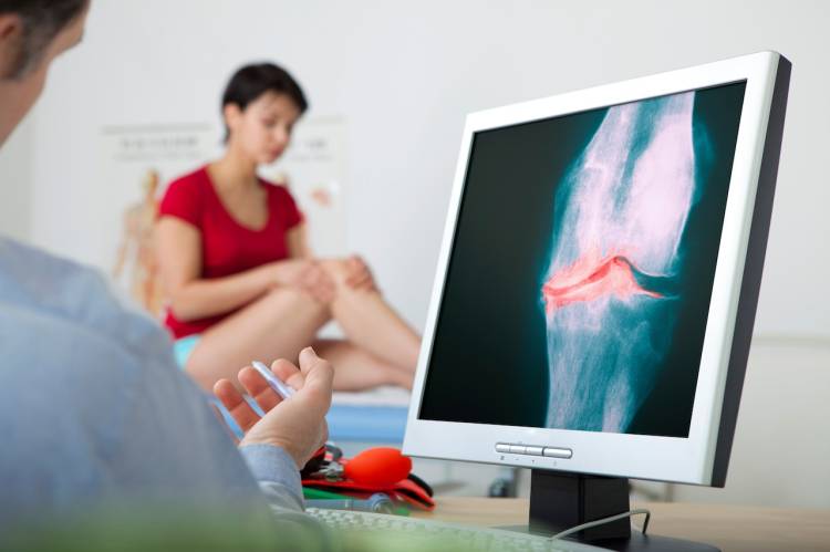 Inovatívna liečba artrózy, ktorá vás môže zachrániť pred výmenou kĺbu