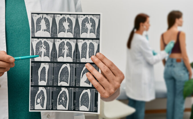 Pľúcna fibróza: Strach z diagnózy nesmie zostať bez slov